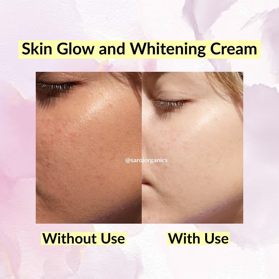 Skin Glowing Bundle Buy 1 (Uptown LA 4 In 1 Super Skin Glowing Serum) & Get 1 (Free Uptown LA 4 In 1 Whitening Cream)